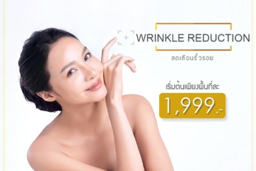 Wrinkle Reduction