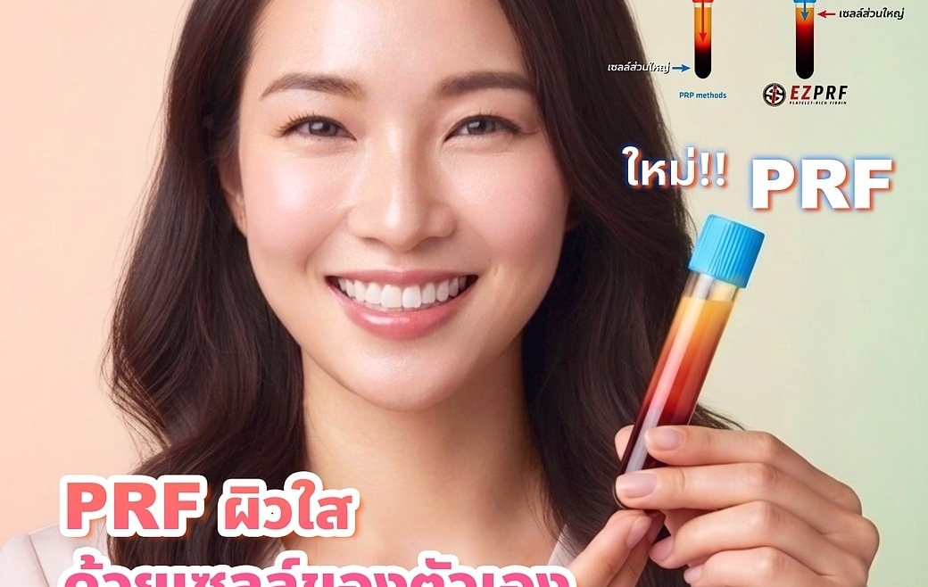 PRF ผิวใส ด้วยเซลล์ตัวเอง
