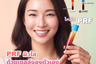 PRF ผิวใส ด้วยเซลล์ตัวเอง