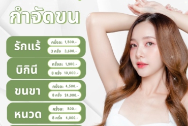 Laser กำจัดขนเริ่มต้นเพียง 800.-